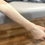 手根管症候群