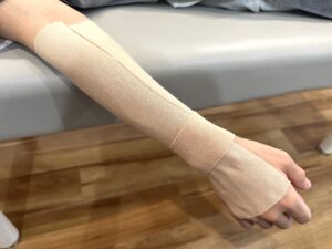 手根管症候群